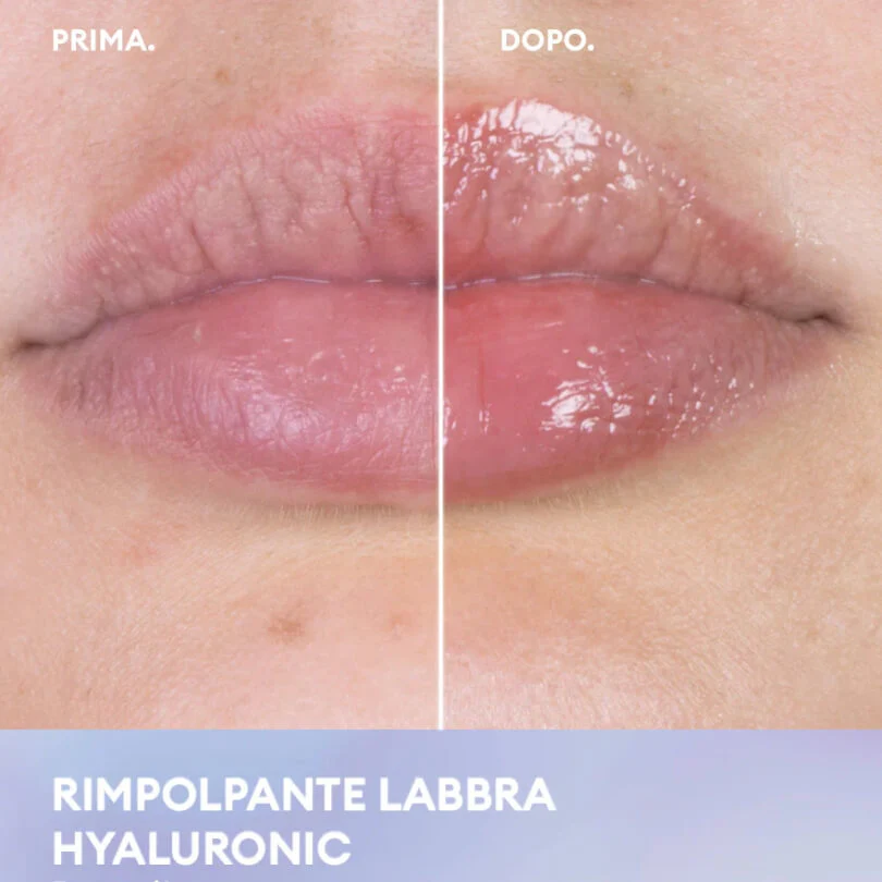 RIMPOLPANTE LABBRA HYALURONIC LIP GLOSS 7 ML - Image 3